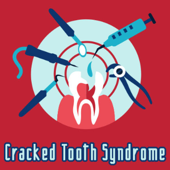 Crack Down On Cracked Tooth Syndrome Cypress Springs Family Dentistry Crack Down On Cracked Tooth Syndrome Cypress Springs Family Dentistry