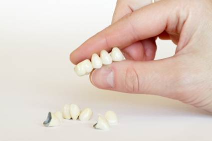 Four Common Questions About Dental Crowns