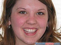 Cypress Springs Family Dentistry - six month smiles after
